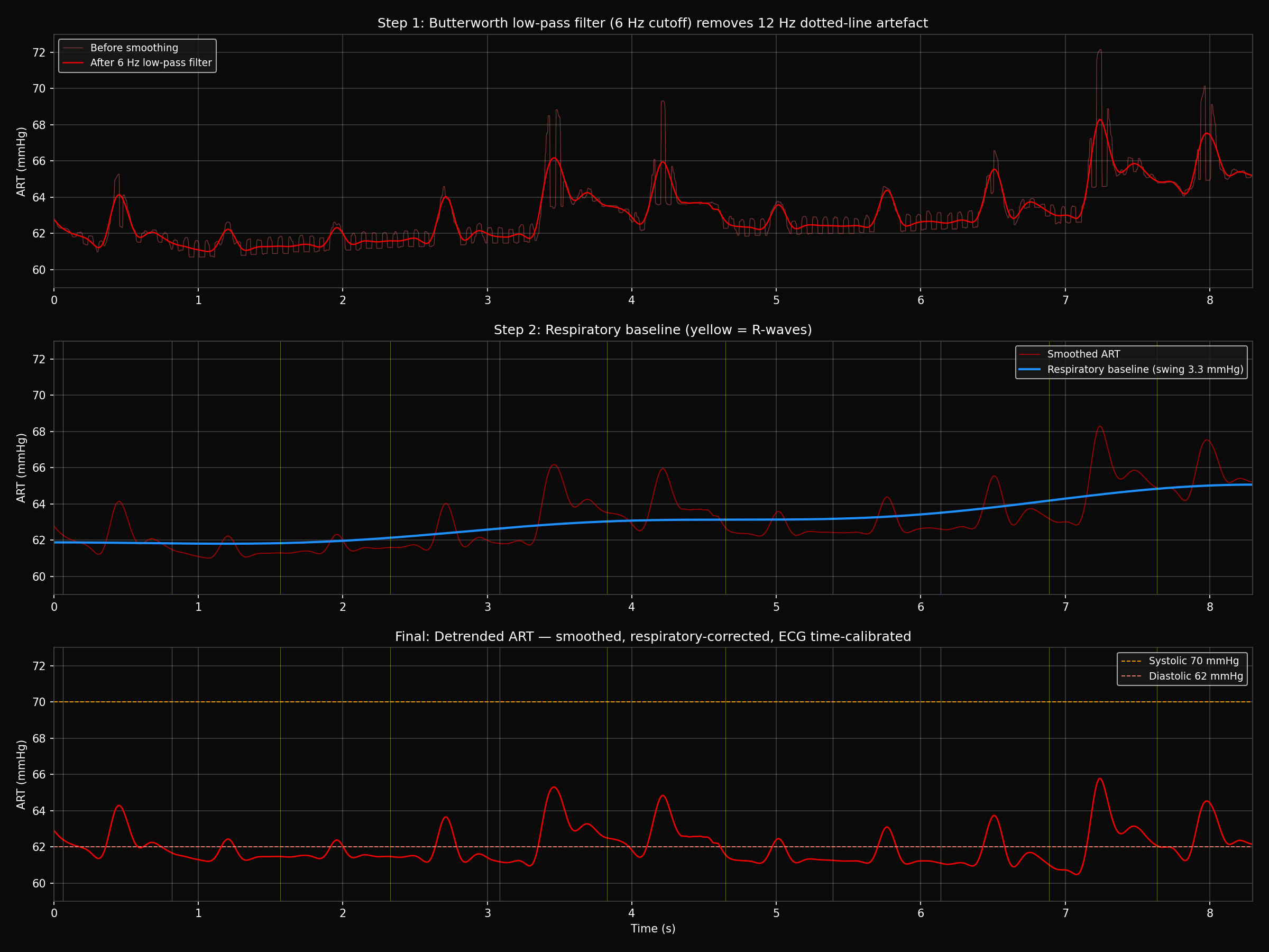 Extracted 250-Hz brachial pressure trace with 6-Hz filtering