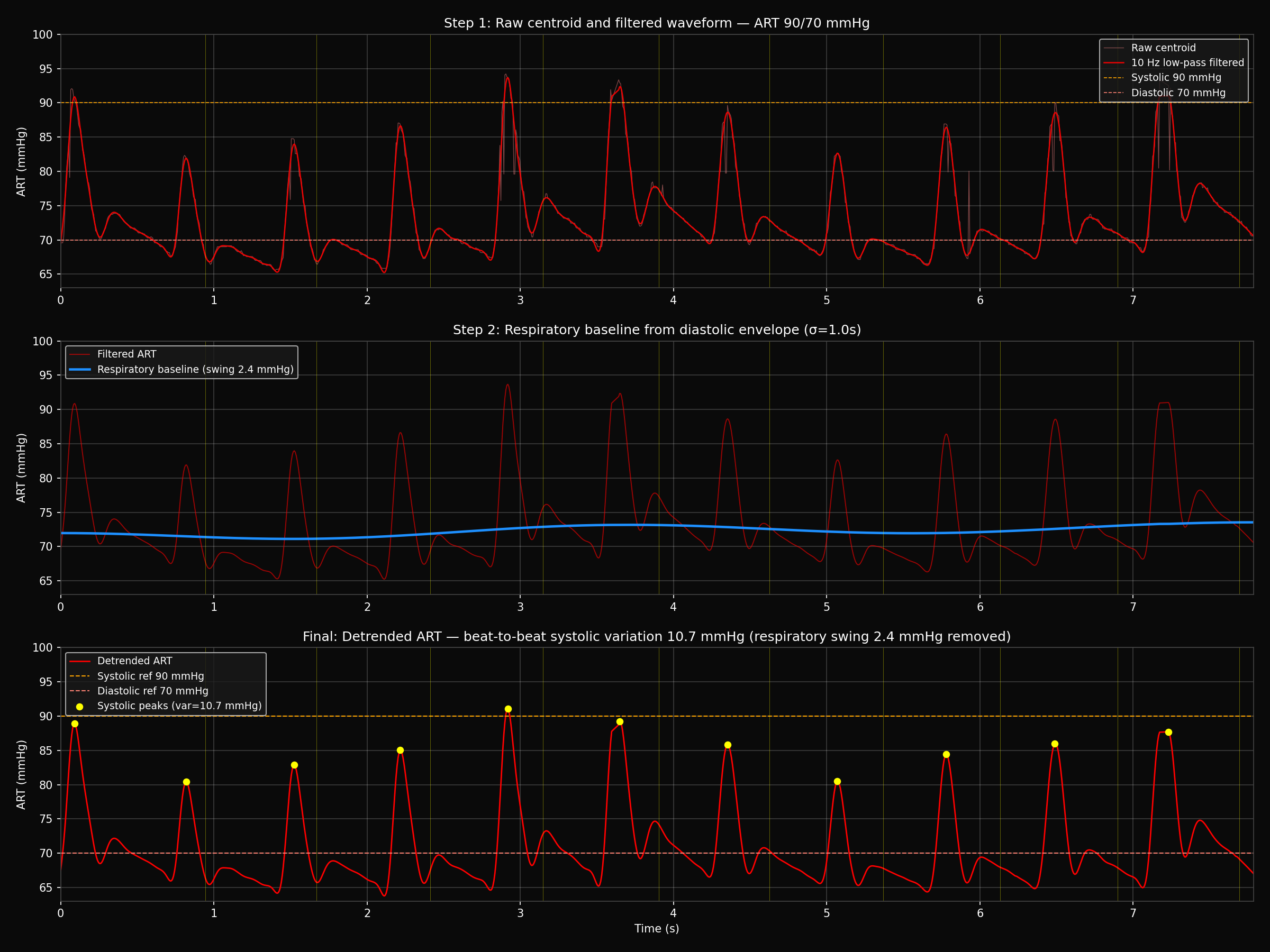 Extracted 250-Hz brachial pressure trace with 10-Hz filtering