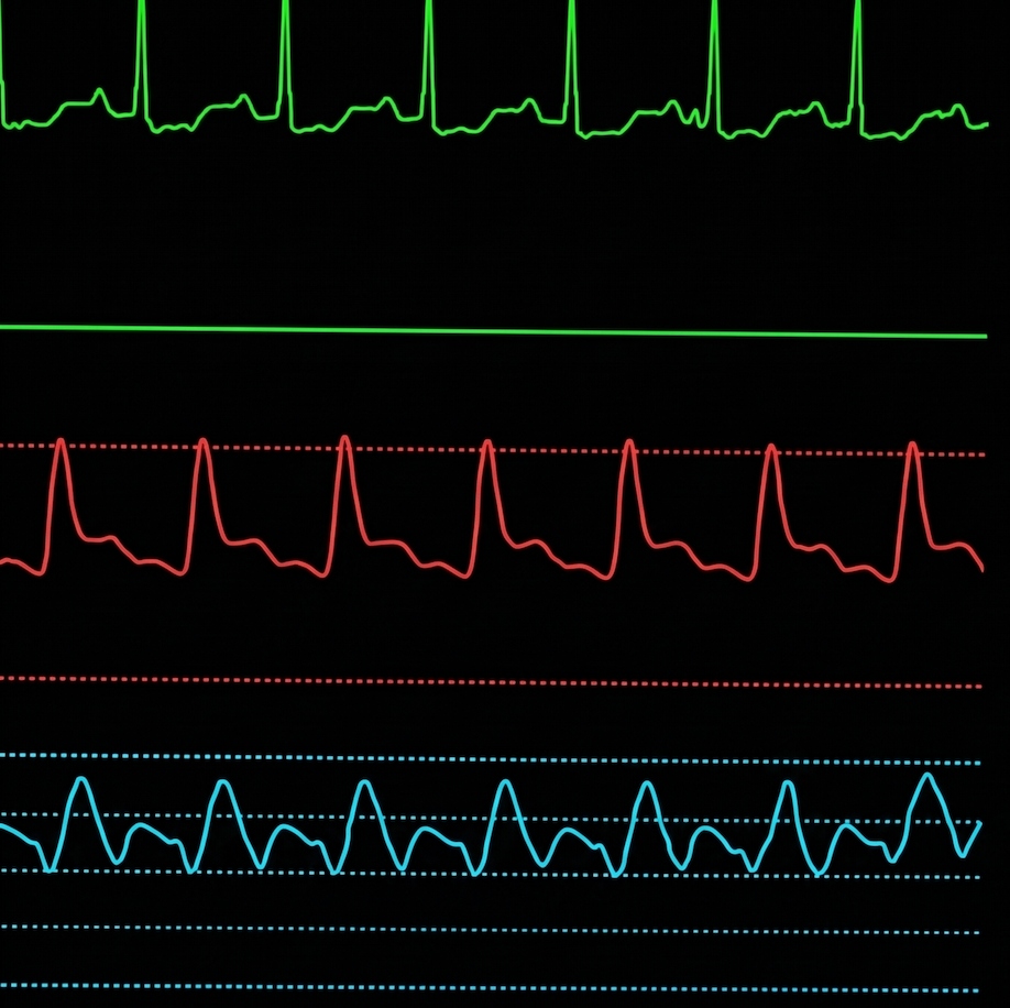 High-frequency bedside monitor waveforms showing ECG, arterial pressure, and CVP